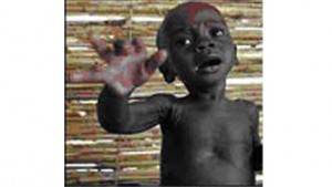 30,000 children die every day of preventable causes.